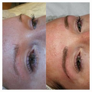 the results of repeated microblading sessions on eyebrows