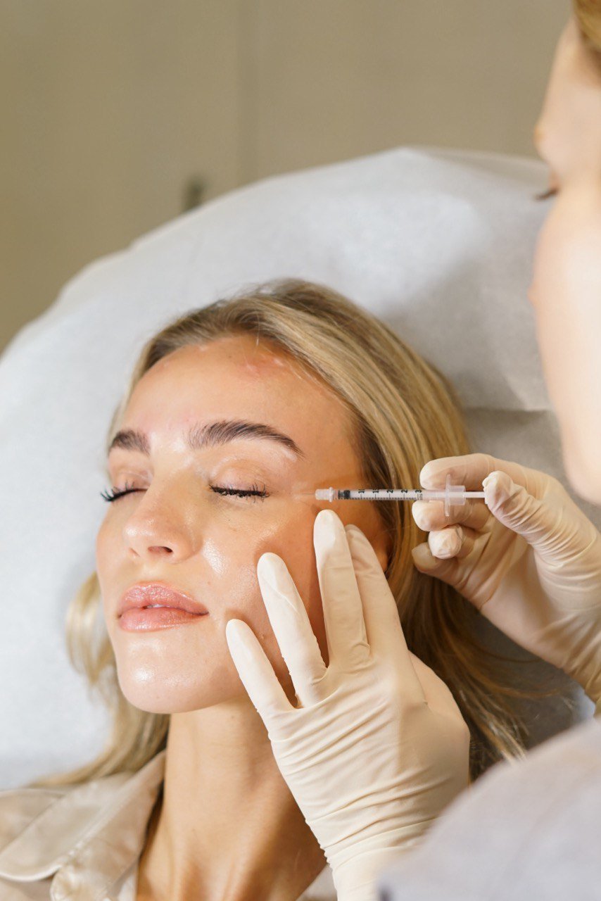 Profhilo Skin Treatment in London