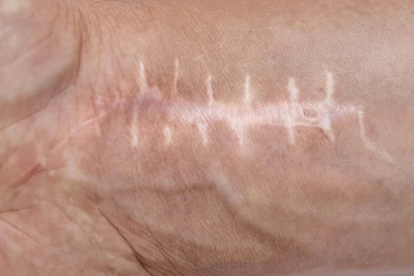 Scar Camouflage for Men